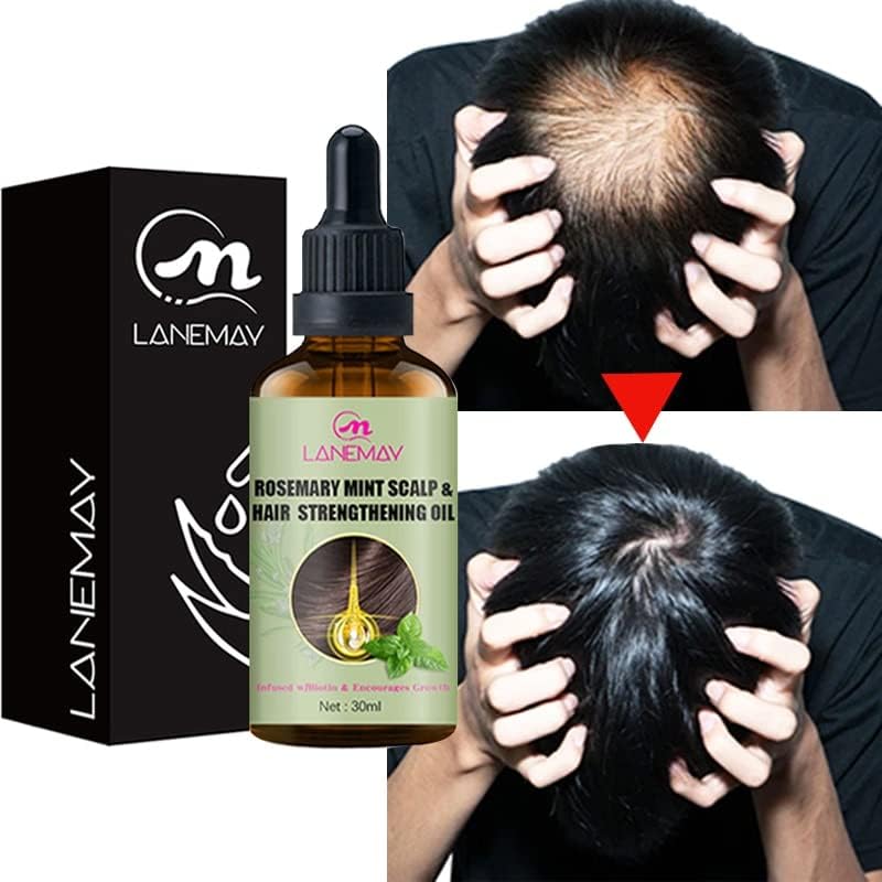Eterično ulje za rast kose serum za obnavljanje kose tekućina za rast kose sredstvo za stanjivanje kose protiv gubitka kose liječenje